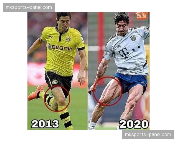 官方：莱万多夫斯基小腿肌肉不适，将缺席两周